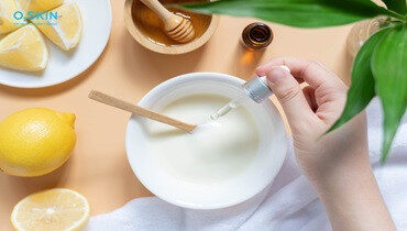 alt text: Hình ảnh da bị mụn