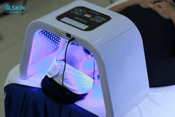 alt text: Hình ảnh minh họa chiếu ánh sáng trị mụn