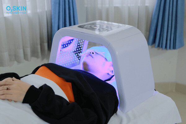 alt="Mụn 2 bên quai hàm"