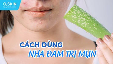 alt="Nha đam trị mụn"