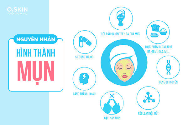 Các nguyên nhân hình thành mụn viêm.