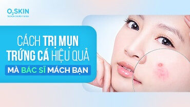 Cách trị mụn trứng cá hiệu quả