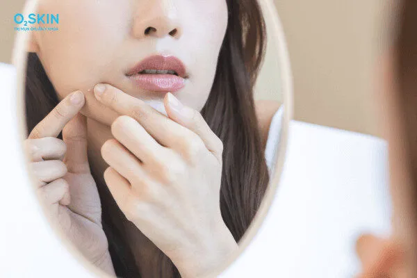 Uống trà nhiều có nổi mụn không? Nguyên nhân và giải pháp