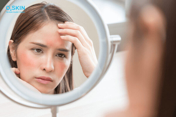 Chăm sóc da không đúng cách là một trong những nguyên nhân khiến da trở nên nhạy cảm hơn.