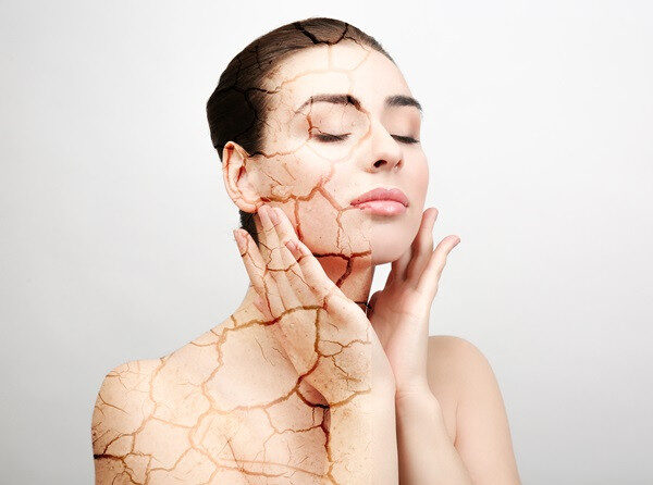 Da khô đến mức bong tróc có thể gây mất thẩm mỹ