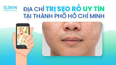 Hình ảnh minh họa tìm kiếm địa chỉ trị sẹo rỗ uy tín