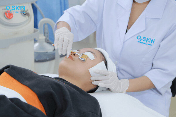 Lăn kim trị sẹo