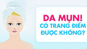 Lưu ý các bước trang điểm cho da mụn hiệu quả, hạn chế gây mụn