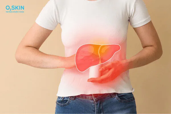 Uống thuốc mát gan có hết mụn không? Những lưu ý cần biết